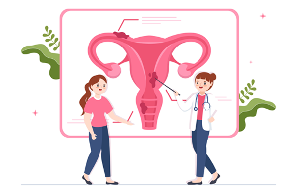 PCOS Treatment